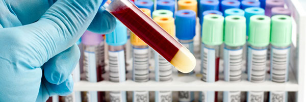 иммунологический анализ крови